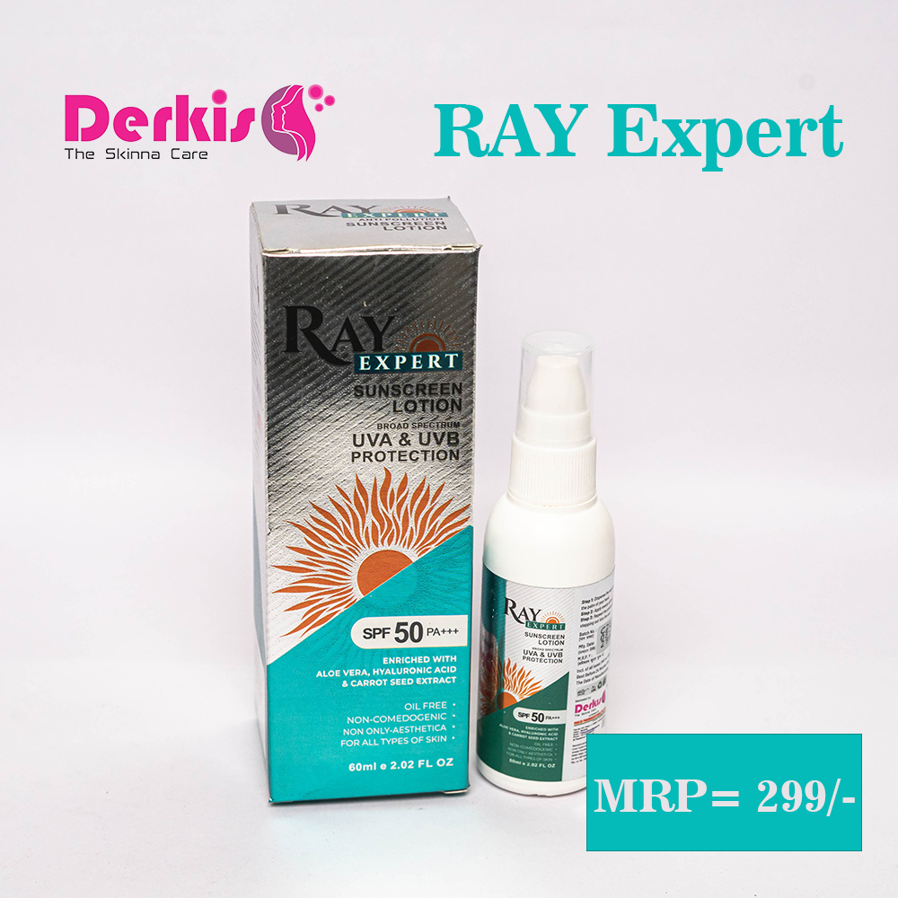 RAY-EXPERT